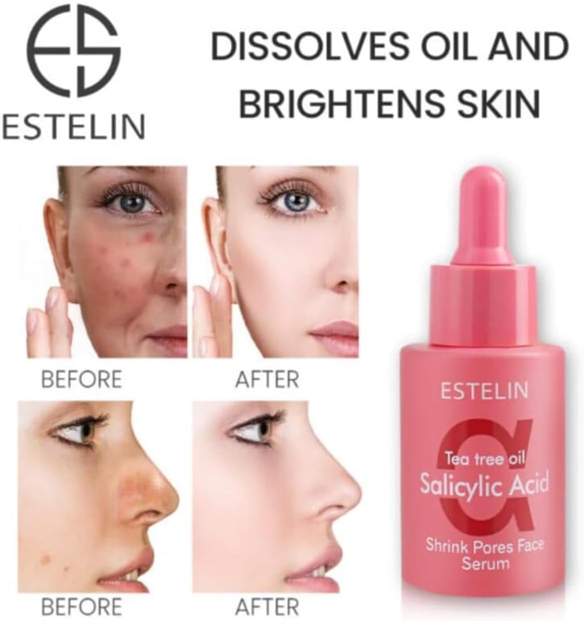 61jGfqcH4WL. AC SL1409