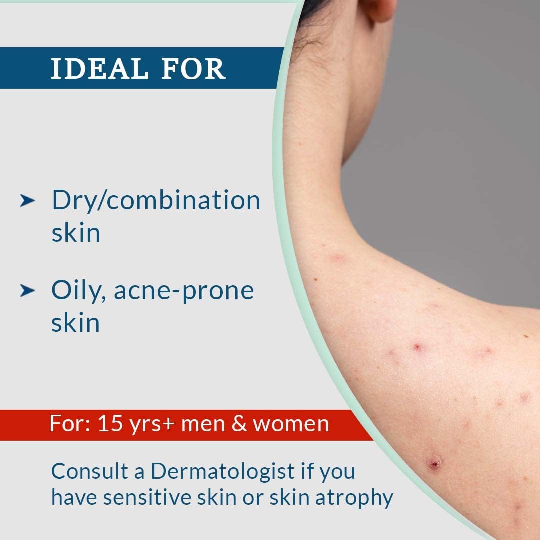 61twXFG0VJL. AC SL1080