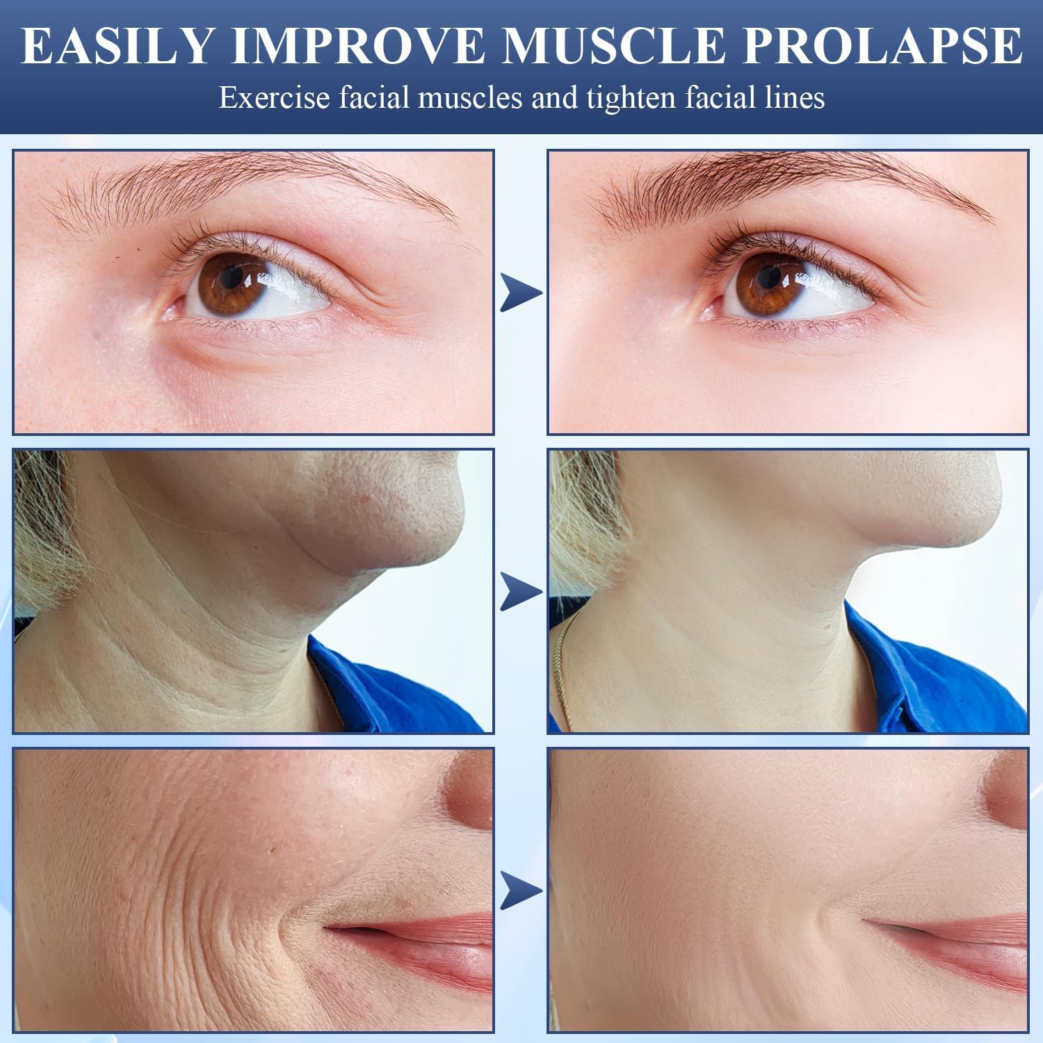 120 قطعة من شريط شد الوجه غير المرئي من يلا جوي، شريط شد الوجه غير المرئي، ملصق شد الوجه الفوري، شرائط وجه على شكل حرف V للبشرة المترهلة للذقن المزدوجة 4 120 قطعة من شريط شد الوجه غير المرئي من يلا جوي، شريط شد الوجه غير المرئي، ملصق شد الوجه الفوري، شرائط وجه على شكل حرف V للبشرة المترهلة للذقن المزدوجة - الصورة 4