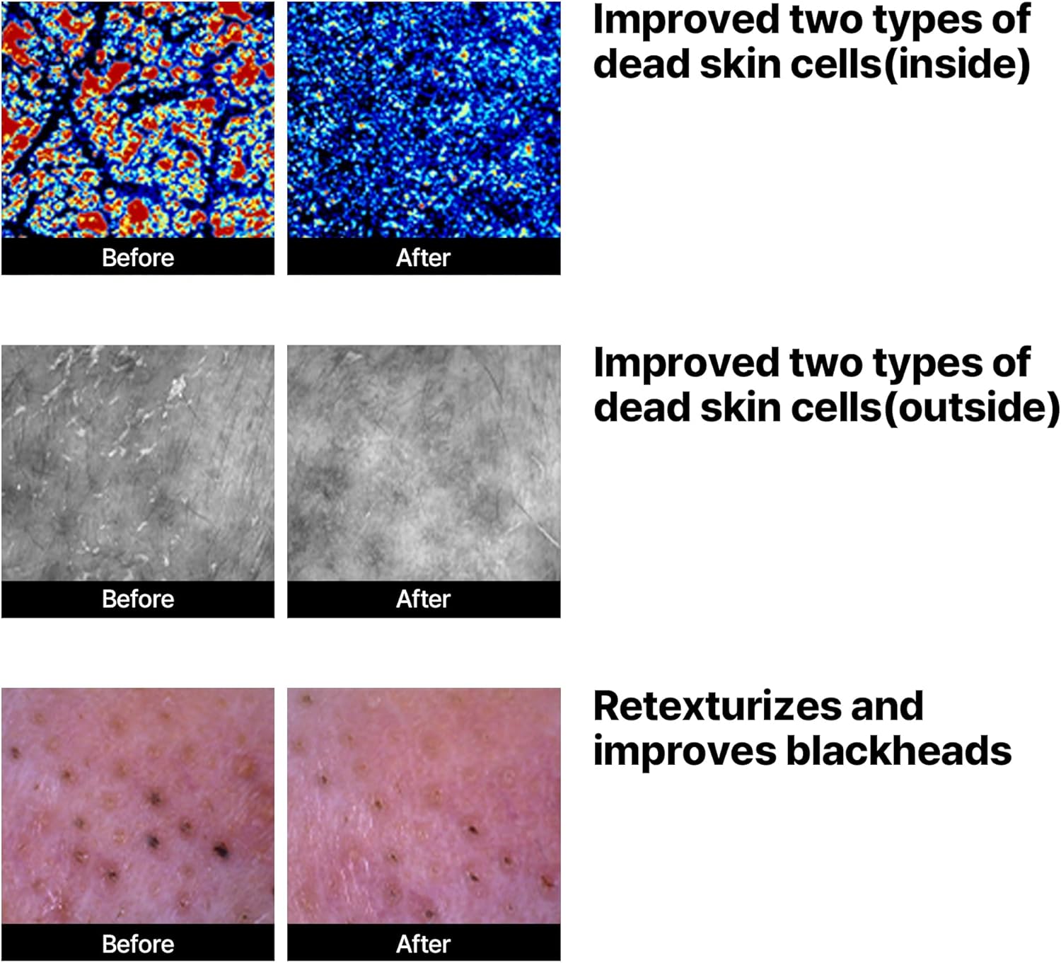 سوم من مي منظف تقشير فقاعات الصويا الخفيف لاكتو | يساعد على استعادة البشرة الناعمة | يزيل شوائب | غنية تنظف الحساسة بلطف | 180 مل 11 71Gz2BLBmDL. AC SL1500