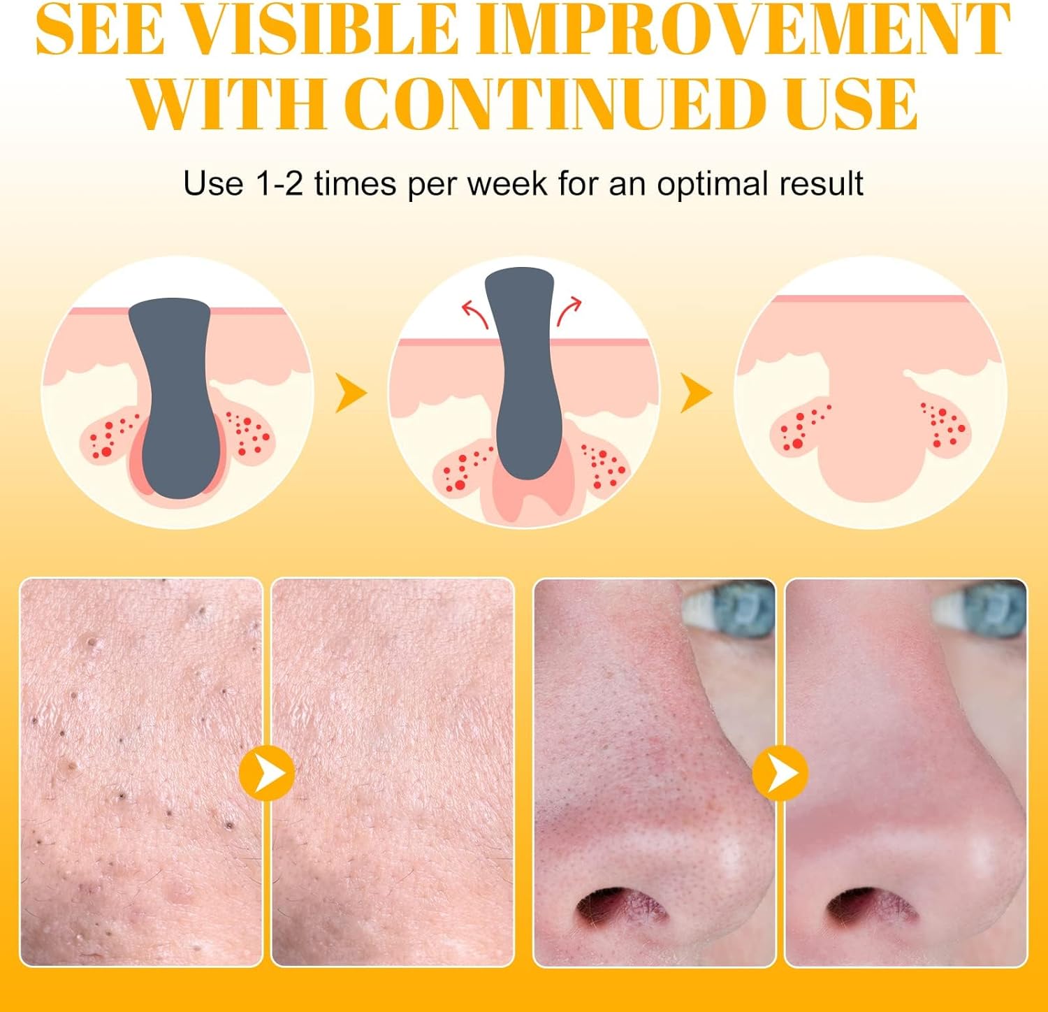 80 قطعة من شرائط ازالة الرؤوس السوداء من بوكيلا، لازالة الرؤوس السوداء الفحمية، للعناية بالبشرة والتنظيف العميق، مزيل الرؤوس السوداء، منظف مسام الانف والوجه، لجميع انواع البشرة 2 80 قطعة من شرائط ازالة الرؤوس السوداء من بوكيلا، لازالة الرؤوس السوداء الفحمية، للعناية بالبشرة والتنظيف العميق، مزيل الرؤوس السوداء، منظف مسام الانف والوجه، لجميع انواع البشرة - الصورة 2