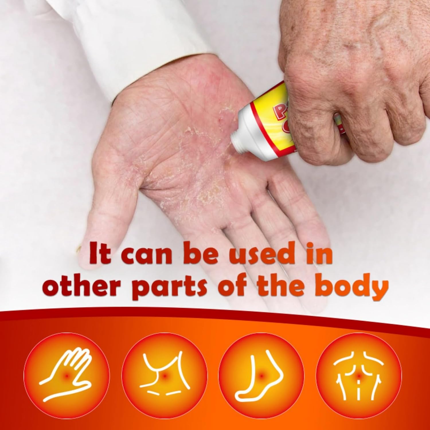 كريم الصدفية من هونبولو - تخفيف عالي القوة لمشاكل الحكة المختلفة - تركيبة طبيعية للبشرة المهيجة والملتهبة - يدوم طويلًا - سريع الامتصاص وغير دهني 60 جرام 6 كريم الصدفية من هونبولو - تخفيف عالي القوة لمشاكل الحكة المختلفة - تركيبة طبيعية للبشرة المهيجة والملتهبة - يدوم طويلًا - سريع الامتصاص وغير دهني 60 جرام - الصورة 6