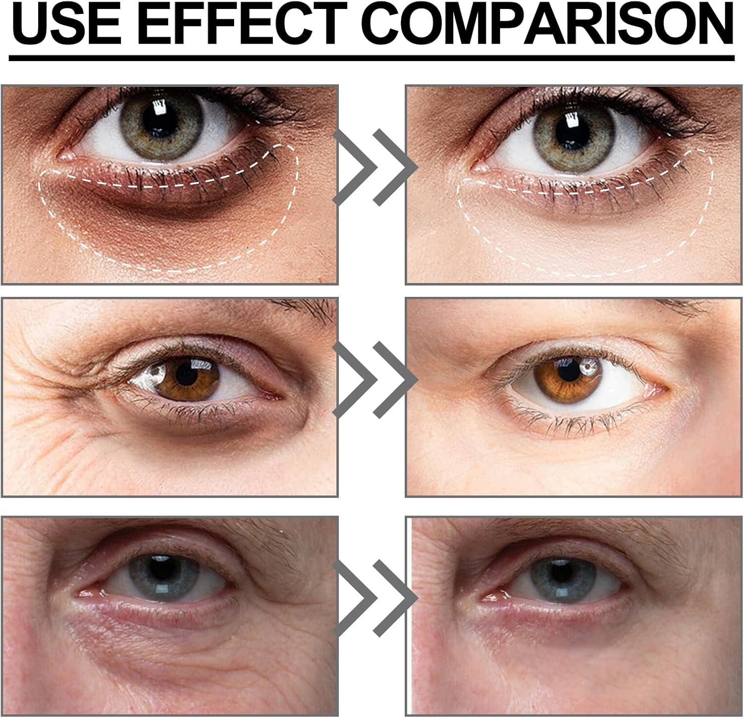 كريم للعيون من نوفولان يقلل الهالات السوداء ويرطب منطقة تحت العين وينعم الخطوط الدقيقة، 15 مل 6 كريم للعيون من نوفولان يقلل الهالات السوداء ويرطب منطقة تحت العين وينعم الخطوط الدقيقة، 15 مل - الصورة 6