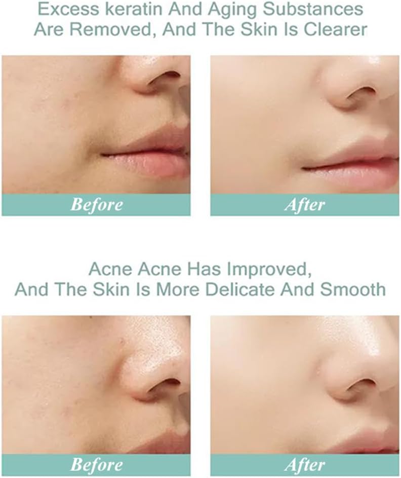 51jSkpL+aBL. AC SL1000