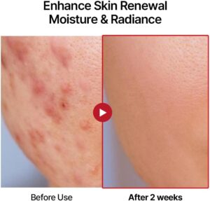 سوانكوكو سيروم ترطيب وتصليح البشرة من بي دي ار ان - قوي مضاد للشيخوخة للوجه والرقبة وتجديد البشرة والتئام الجروح والعناية بالبشرة الكورية، 15 مل (0.5