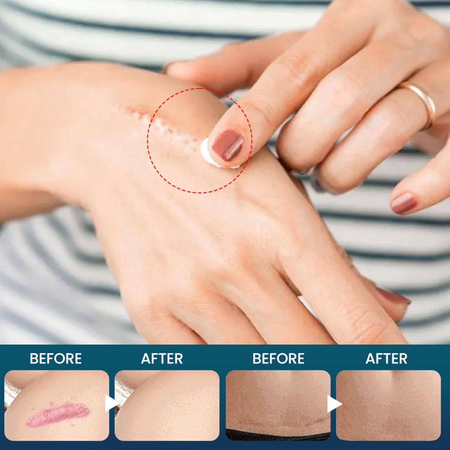 71RKjXwd bL. AC SL1500