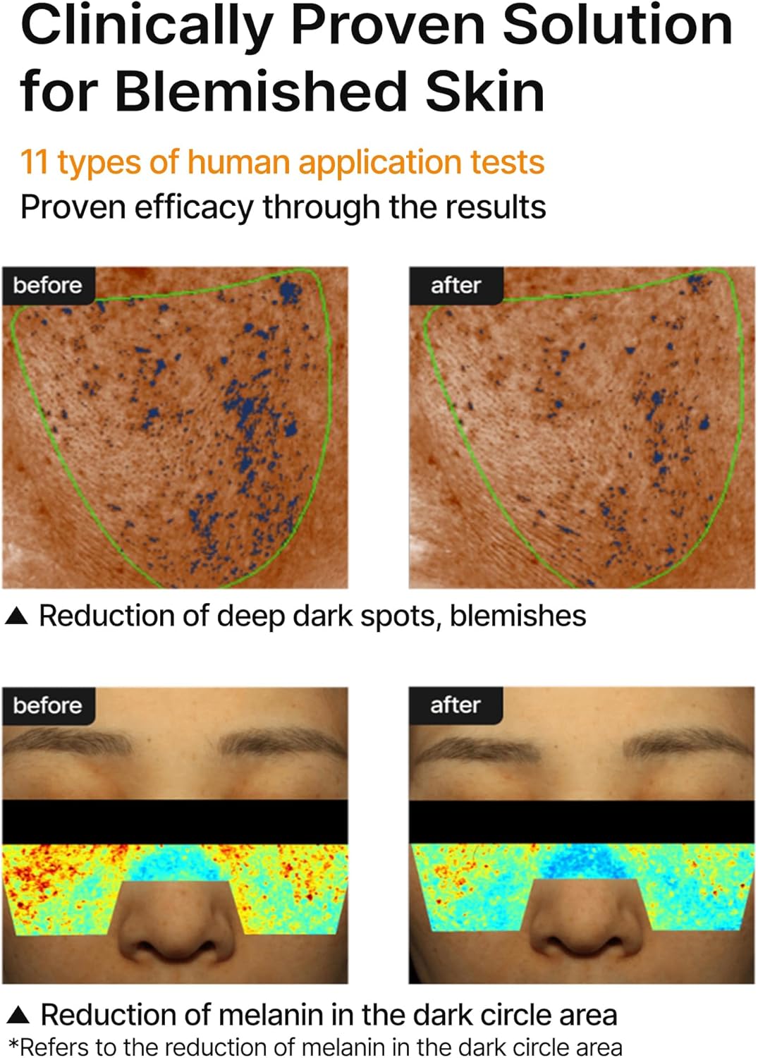 كريم التفتيح بور+دارك سبوت لعلاج المسام الواسعة والبقع الداكنة من سيليماكس، 35 مل 9 71Sva3KTY L. AC SL1500