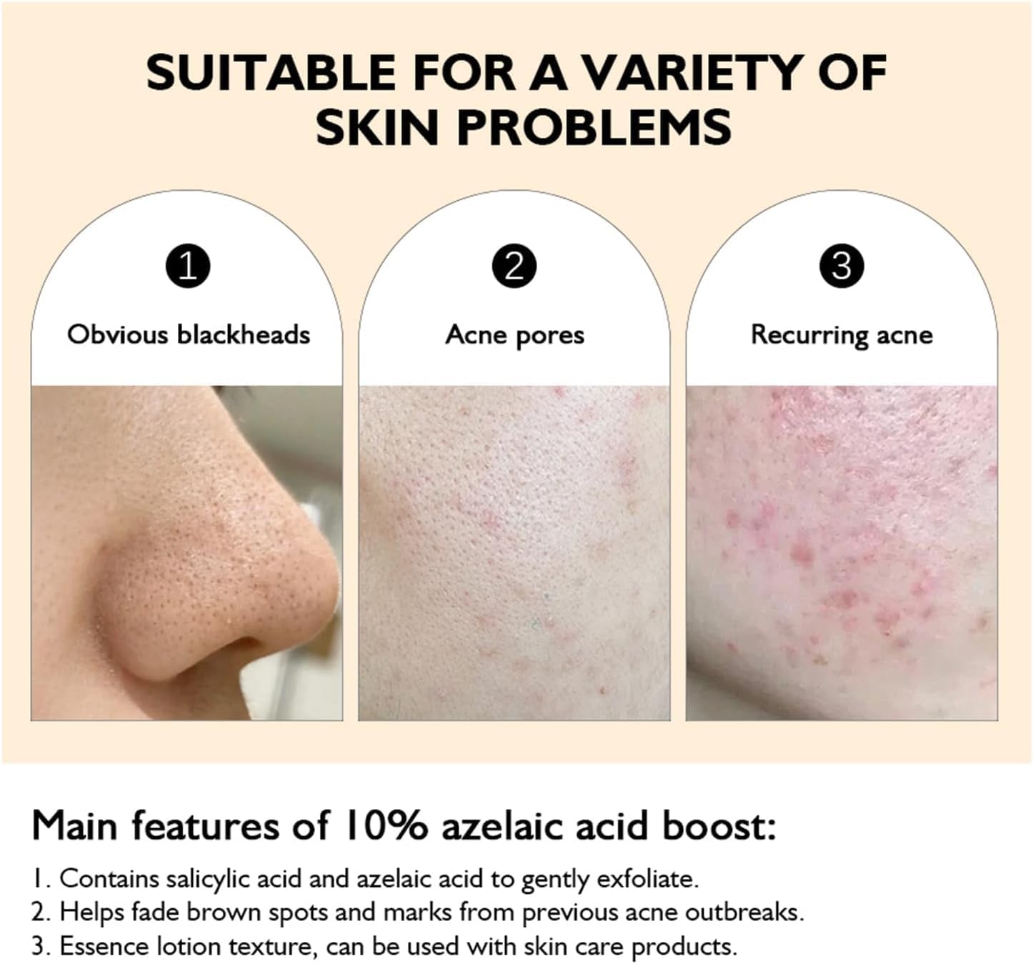 سيروم حمض الازيليك بنسبة 10% مع جذور عرق السوس (30 مل)، تركيبة خفيفة الوزن للون البشرة غير المتساوية والبقع الداكنة وعلامات حب الشباب يحسن ملمس البشرة ويقلل من ظهور البثور والرؤوس السوداء وتصبغ البشرة 13 619P77nk 8L. AC SL1446