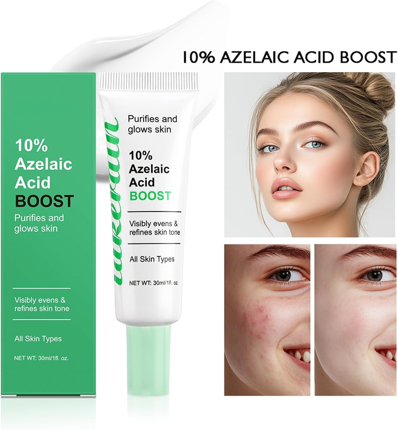 سيروم حمض الازيليك بنسبة 10% مع جذور عرق السوس (30 مل)، تركيبة خفيفة الوزن للون البشرة غير المتساوية والبقع الداكنة وعلامات حب الشباب يحسن ملمس البشرة ويقلل من ظهور البثور والرؤوس السوداء وتصبغ البشرة 12 61D5KEvCeWL. AC SL1500