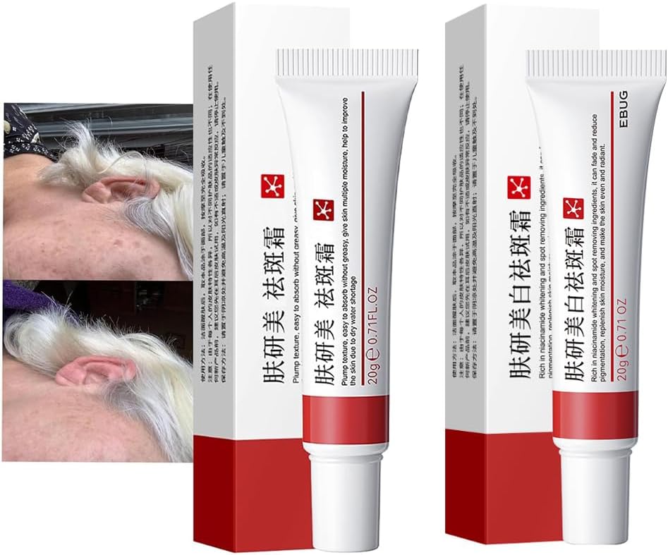 كريم التفتيح وعلاج النمش وإزالة ندبات حب الشباب، كريم إزالة تصبغ الوجه، مرطب يزيل الكلف والبقع الداكنة والتجاعيد والعيوب، 2 قطعة (كريم التفتيح وإزالة النمش) 8 كريم التفتيح وعلاج النمش وإزالة ندبات حب الشباب، كريم إزالة تصبغ الوجه، مرطب يزيل الكلف والبقع الداكنة والتجاعيد والعيوب، 2 قطعة (كريم التفتيح وإزالة النمش)