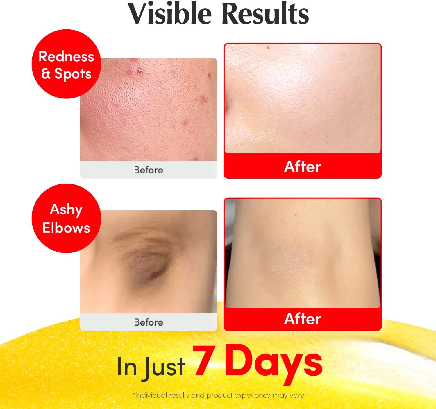 سيروم تفتيح البشرة ايكوالبيري بفيتامين سي: سيروم تفتيح مع اسيرولا ونياسيناميد، يقوي حاجز البشرة، يرطب بالسيراميد وحمض الهيالورونيك 1.01 اونصة/ 30 مل 13