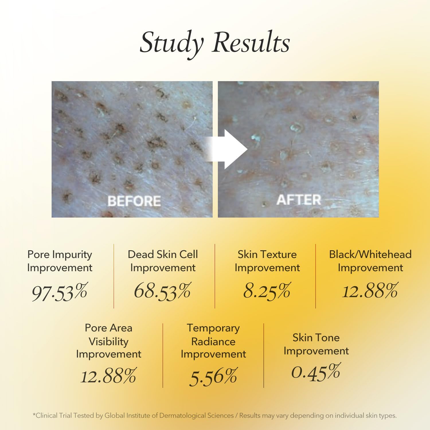 71Q3tqwpGgL. AC SL1500