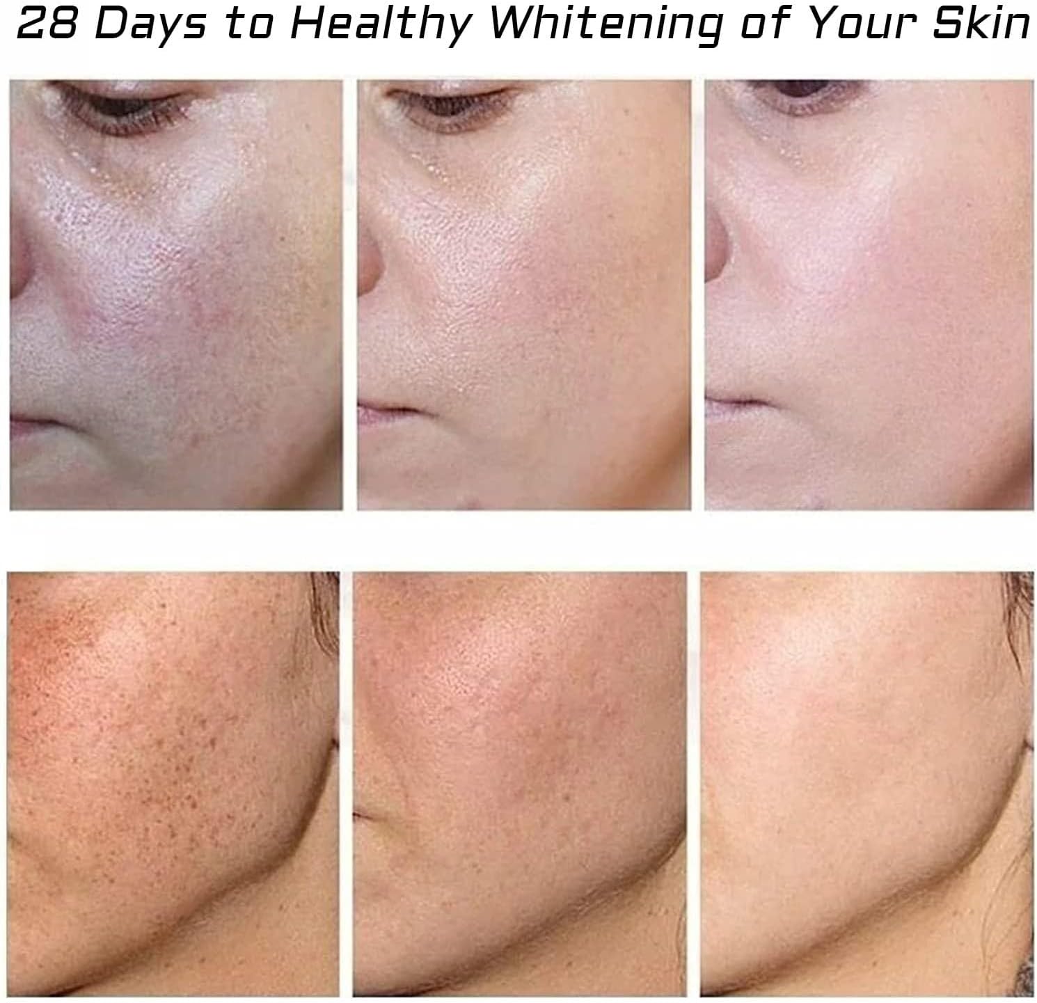 كريم التفتيح وعلاج النمش وإزالة ندبات حب الشباب، كريم إزالة تصبغ الوجه، مرطب يزيل الكلف والبقع الداكنة والتجاعيد والعيوب، 2 قطعة (كريم التفتيح وإزالة النمش) 9 71Sw91R5FAL. AC SL1500