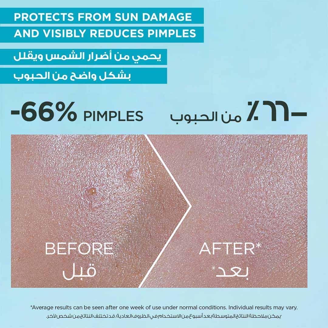 سيروم واقي شمسي سوبر يو في للبشرة المعرضة لحب الشباب من غارنييه سكين اكتيف - بحجم 30 مل 11 71qpfHr0LaL. AC SL1080