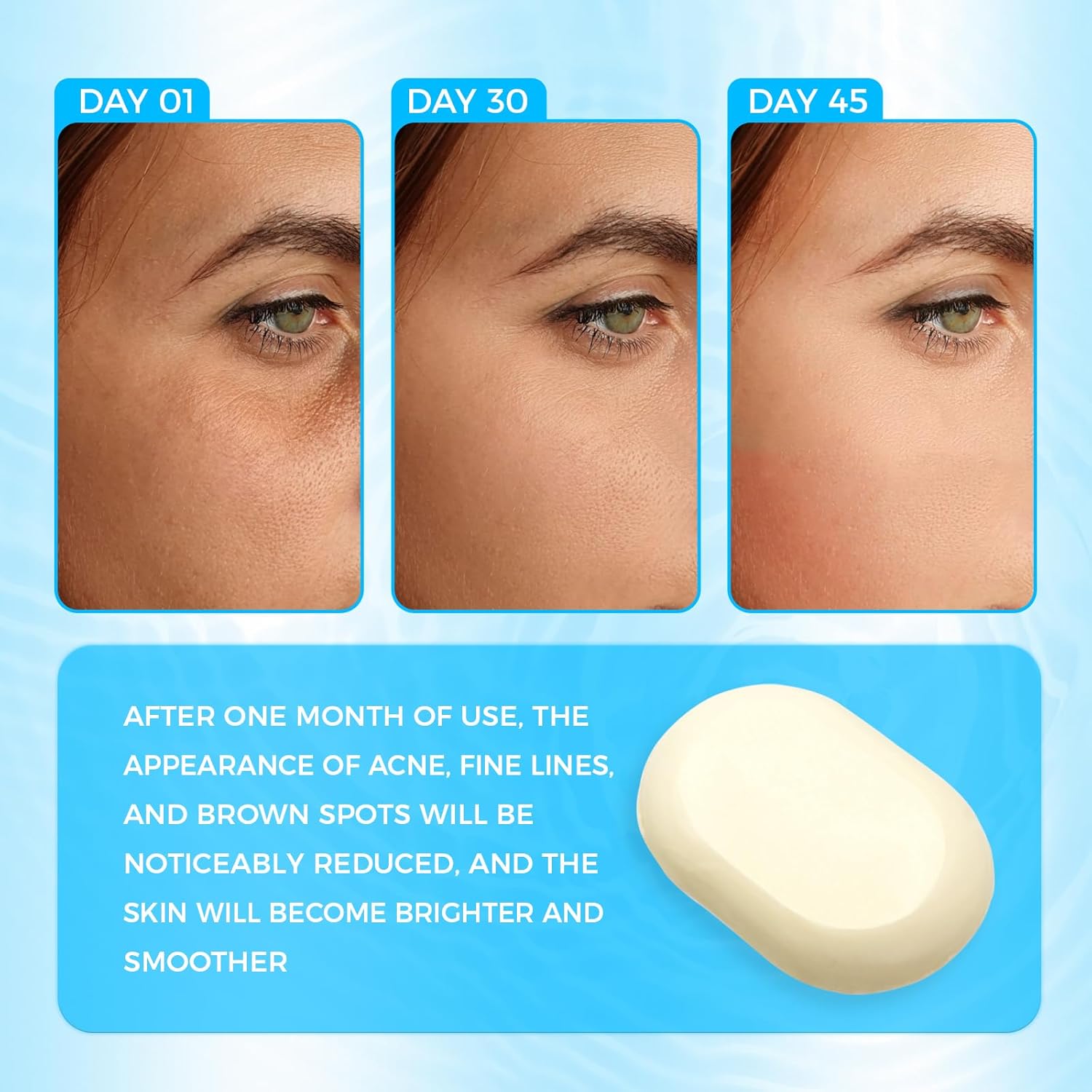 اوكييا صابون كبريت للوجه لعلاج حب الشباب بالكبريت بنسبة 10% وحمض الساليسيليك 2% وحليب الماعز وشجرة الشاي وحمض هيا من الدرجة الصيدلانية 13 71wEb8HdhdL. AC SL1500