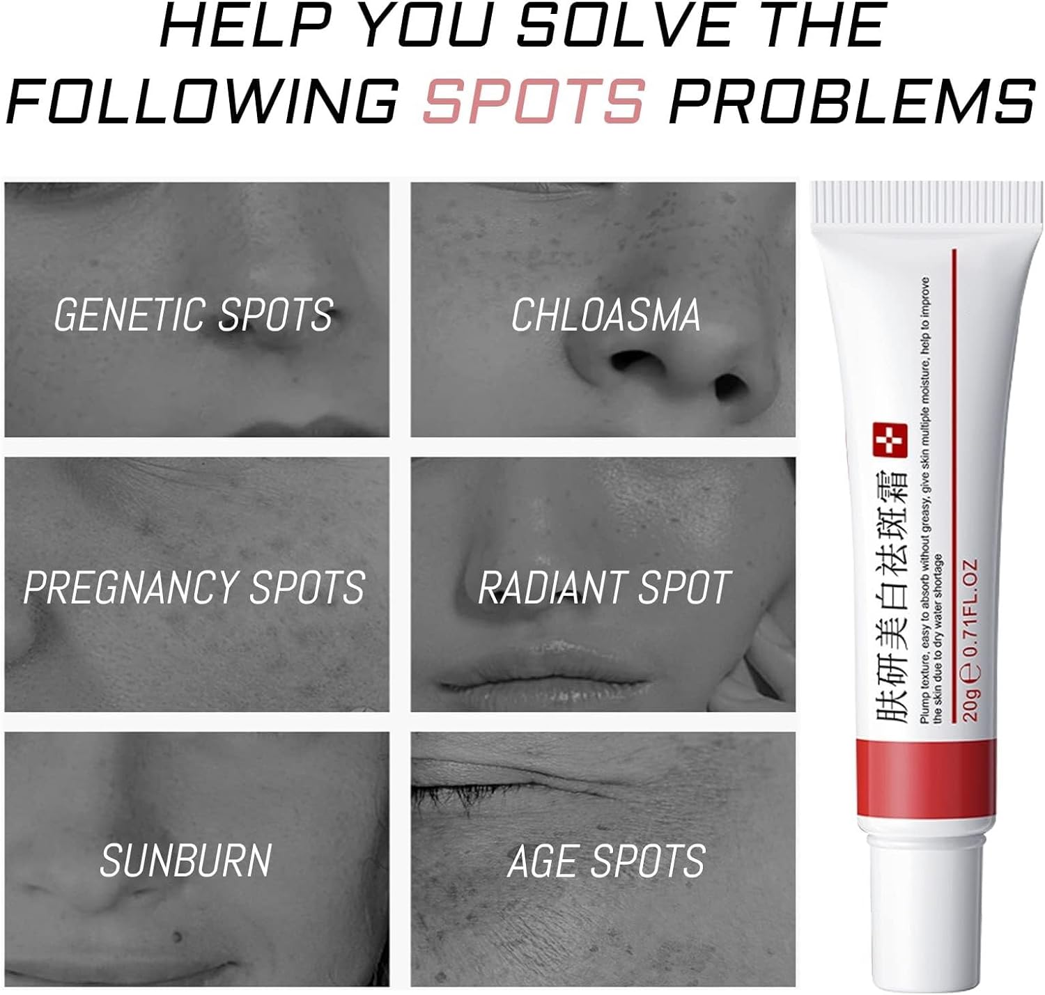 كريم التفتيح وعلاج النمش وإزالة ندبات حب الشباب، كريم إزالة تصبغ الوجه، مرطب يزيل الكلف والبقع الداكنة والتجاعيد والعيوب، 2 قطعة (كريم التفتيح وإزالة النمش) 10