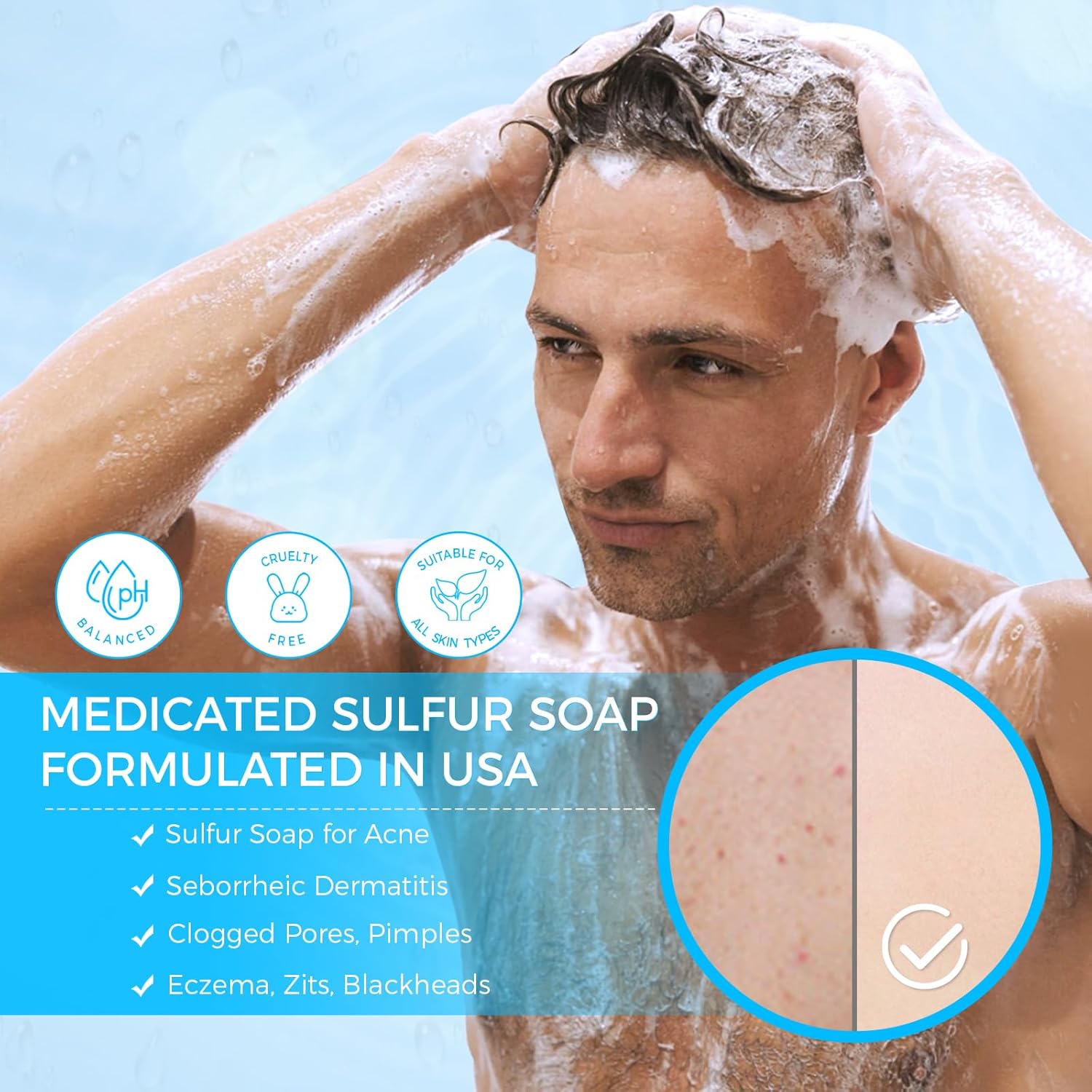 اوكييا صابون كبريت للوجه لعلاج حب الشباب بالكبريت بنسبة 10% وحمض الساليسيليك 2% وحليب الماعز وشجرة الشاي وحمض هيا من الدرجة الصيدلانية 12 71yRCkAfeDL. AC SL1500