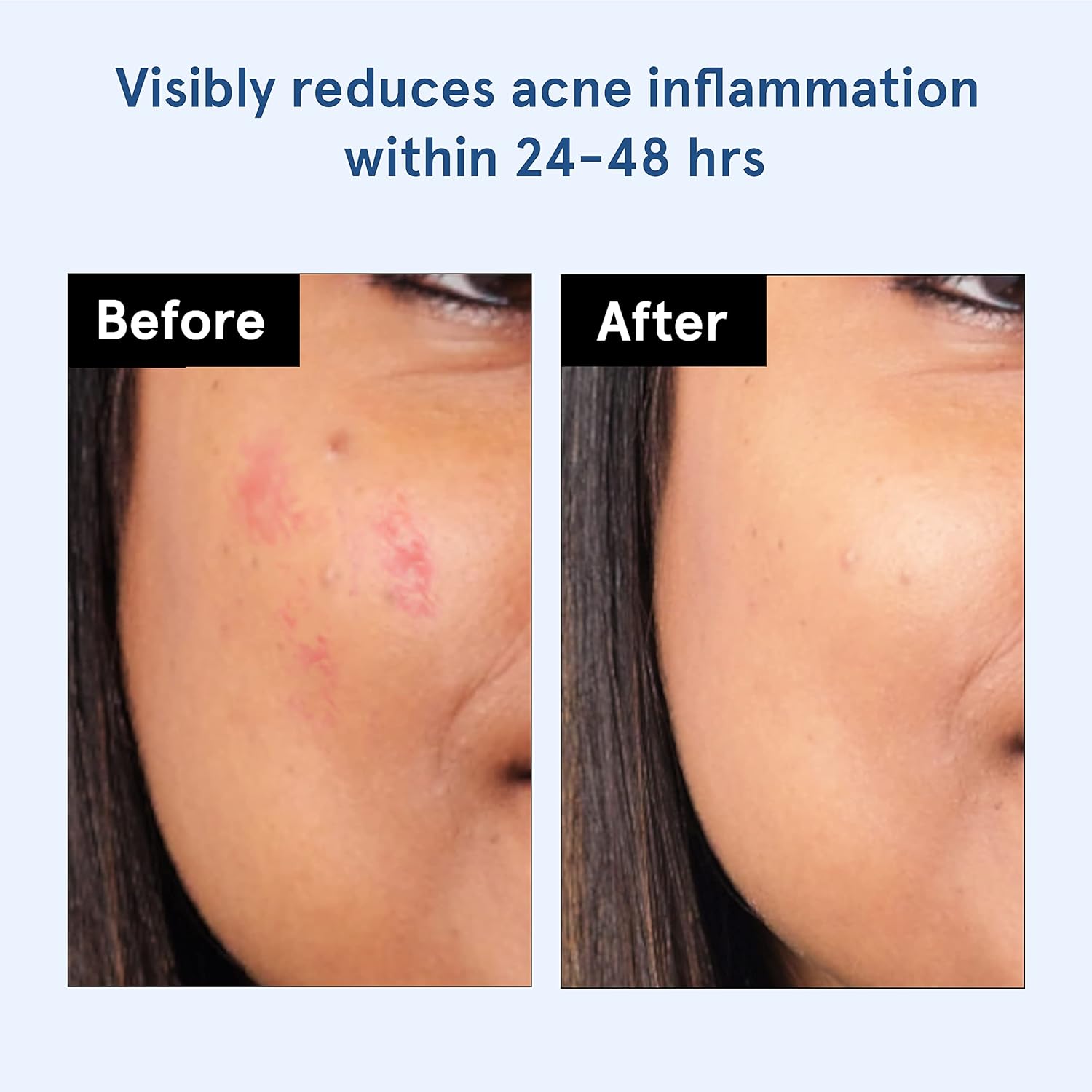 71zIvje8A7L. AC SL1500