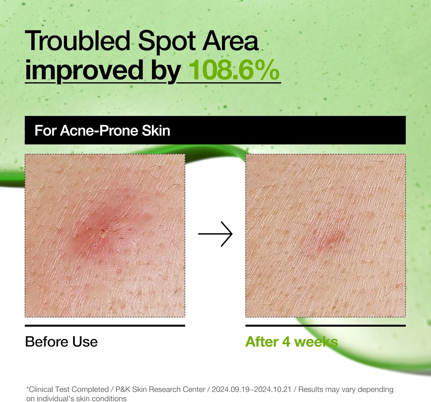 817fLQV odL. AC SL1500