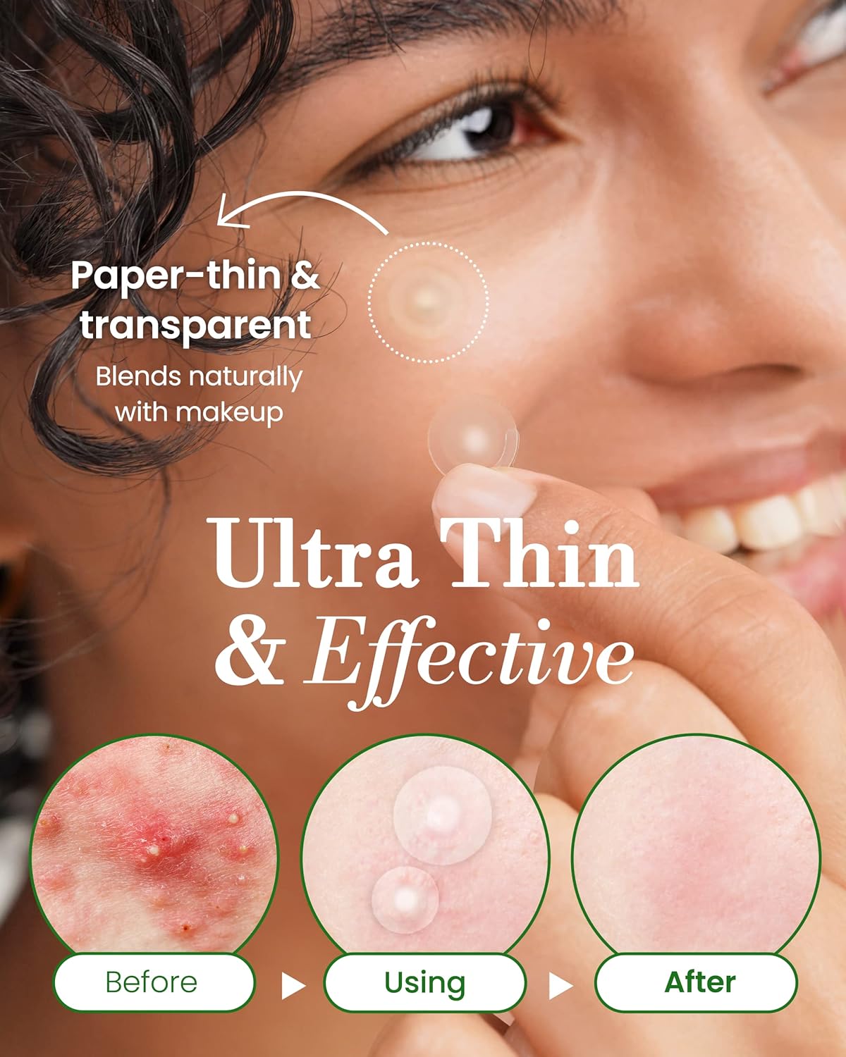 تروبليس رقع بقع بثرة غير مرئية - حب الشباب الغروانية المائية للوجه | رفيعة للغاية مع مقبض سهل التقشير | ليلية | مقاسان 96 قطعة (عبوة من واحدة) 12 81Mru +mJ3L. AC SL1500