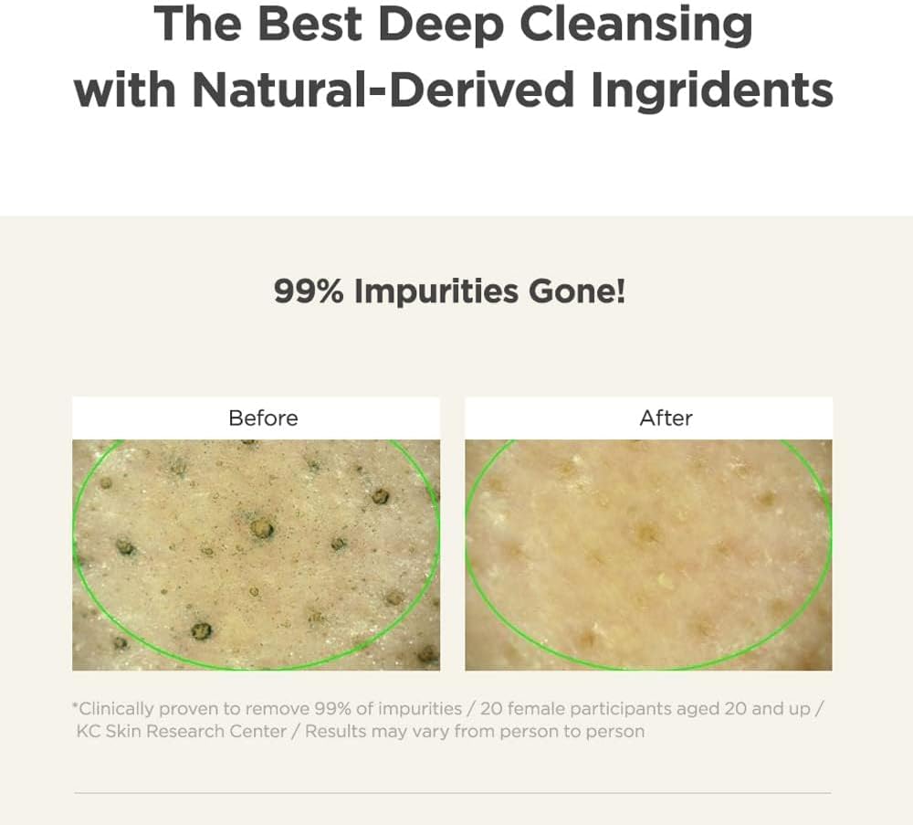 515laYO1v0L. AC SL1000