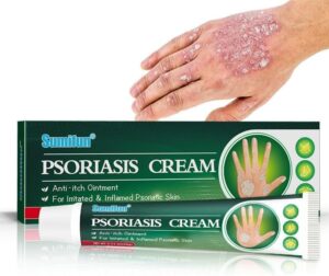 كريم الصدفية القوباء الحلقية للبشرة عشبي صيني طبيعي للاكزيما والصدفية يعمل على تثبيط وحكة الجلد بشكل فعال قطعة واحدة