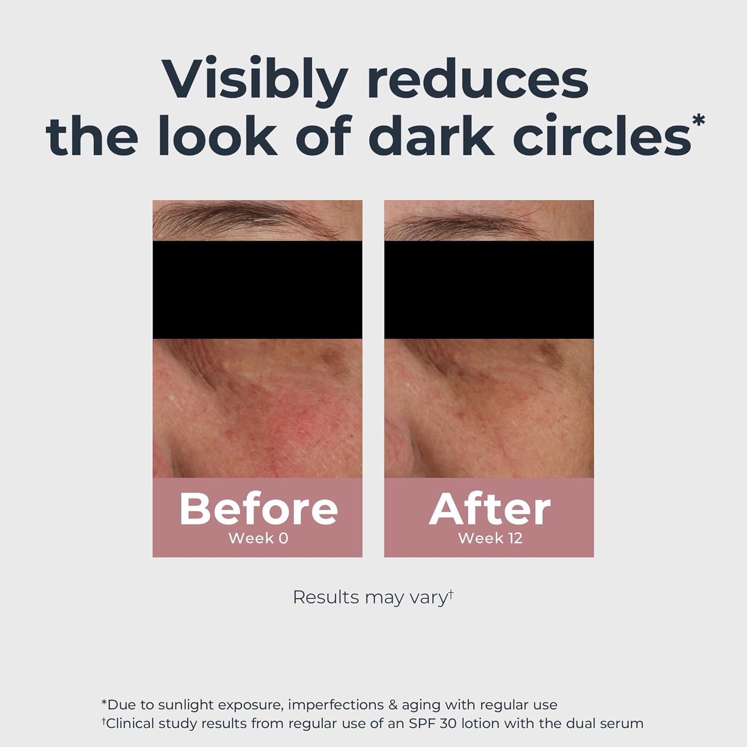 7162Aa3kA5L. AC SL1500