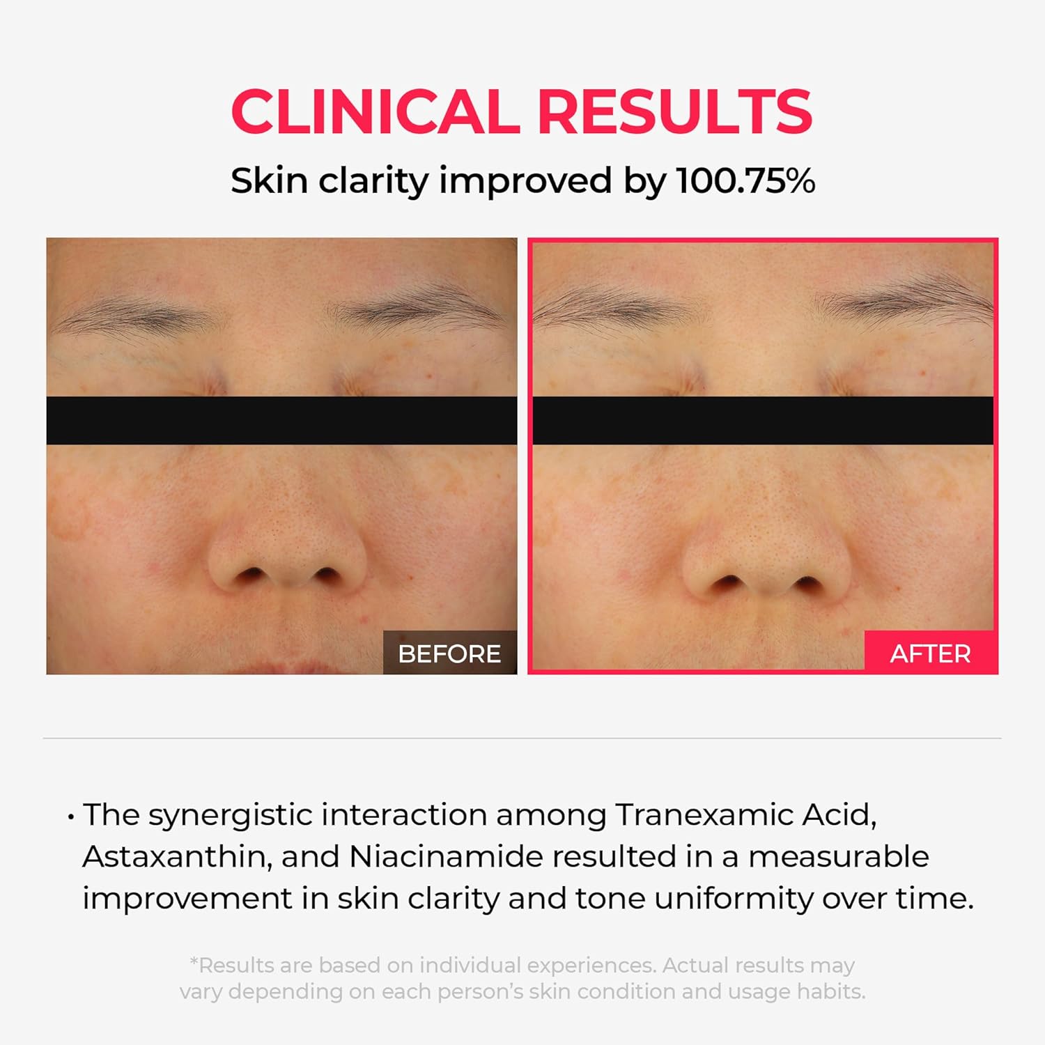 717Q MiOUZL. AC SL1500