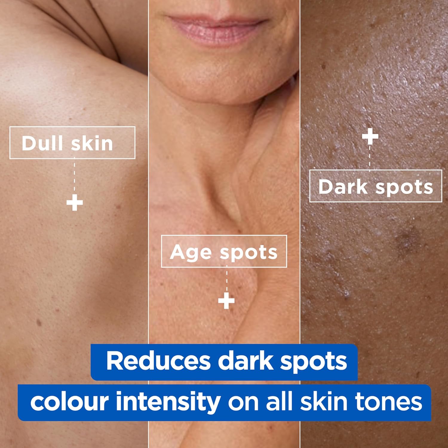 ميكسا كريم نياسيناميد برايت مرطب مضاد للبقع الداكنة، مصحح البقع الداكنة للعناية بالجسم للون غير المتساوي، مع 9% نياسيناميد وزبدة الشيا وفيتامين سي، 400 مل 9 81Uer2LhhoL. AC SL1500